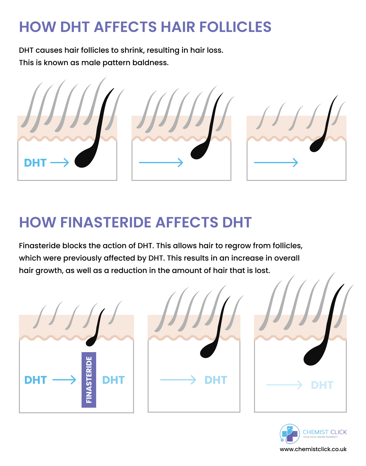 What Is DHT Why Does It Cause Hair Loss