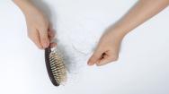 Hair Loss Collected on a Hairbrush