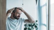 Male Inspecting Hair Loss